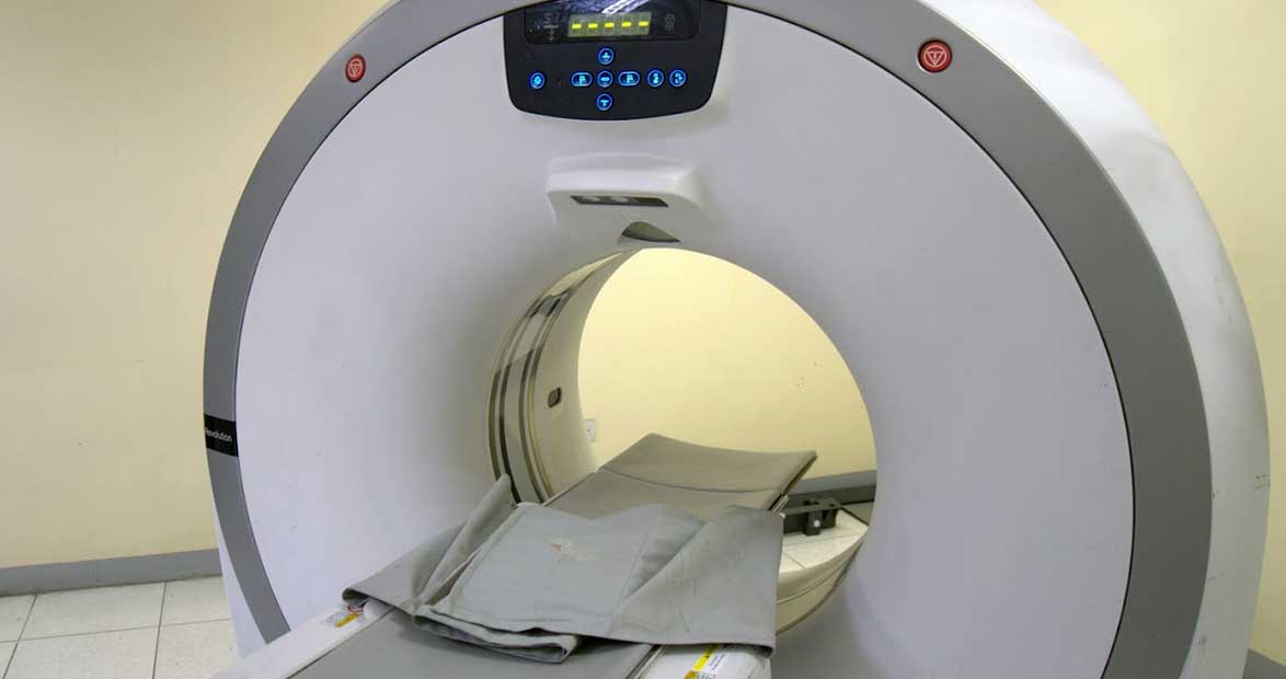 CT-Scan1